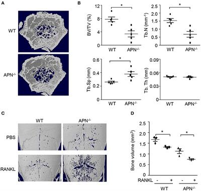 Adiponectin Deficiency Triggers Bone Loss by Up-Regulation of Osteoclastogenesis and Down-Regulation of Osteoblastogenesis